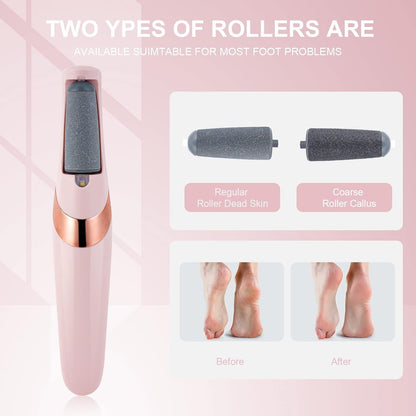 ✨Today's Special Offer 49% OFF🎉 -  Cordless Electric Callus and Dead Skin Remover for Feet