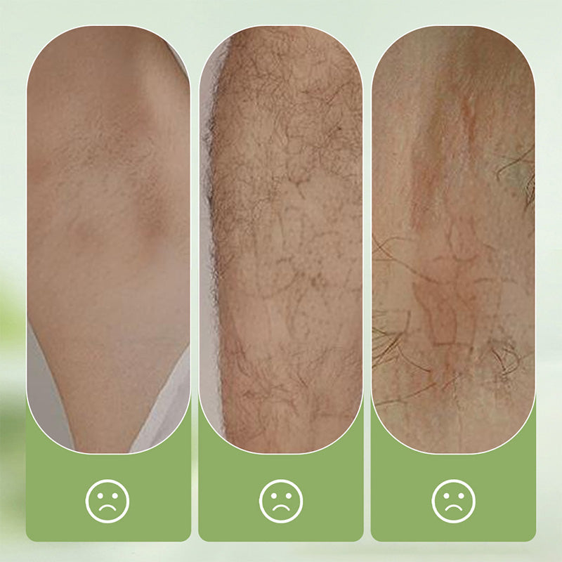 🦵🏻Summer Hot Sale - ONLY 9.99!!💥 Large-capacity Gentle Hair Removal Cream Set: Includes Hair Removal Cream + Smoothing Razor