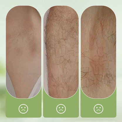 🦵🏻Summer Hot Sale - ONLY 9.99!!💥 Large-capacity Gentle Hair Removal Cream Set: Includes Hair Removal Cream + Smoothing Razor