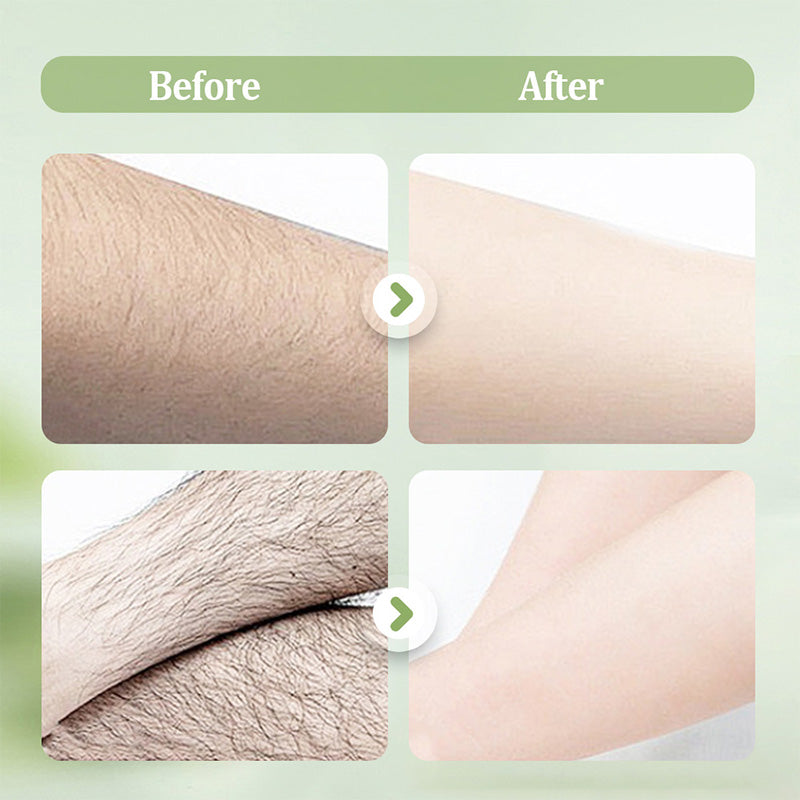 🦵🏻Summer Hot Sale - ONLY 9.99!!💥 Large-capacity Gentle Hair Removal Cream Set: Includes Hair Removal Cream + Smoothing Razor
